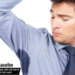 Ra mồ hôi nhiều vùng nách và cách ngăn tiết mồ hôi nách ngay tức thì