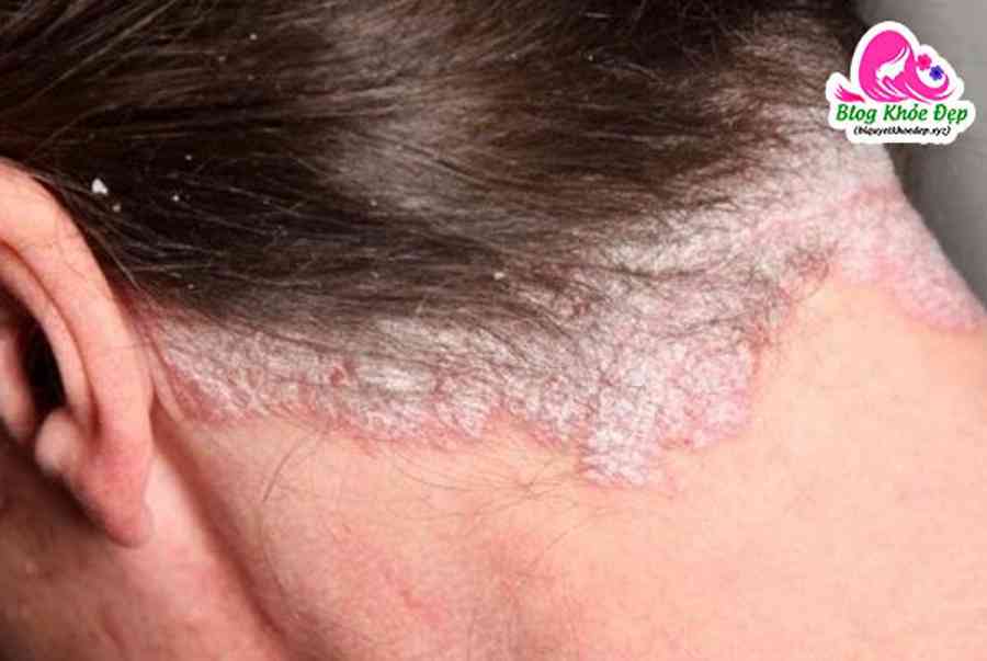 Tóc Bạc Sớm Nên Nhuộm Màu Gì Cho Hợp? (Cập nhật 2022)